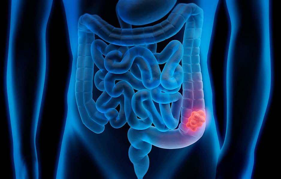 Gastro-enterologie: diagnose behandeling van spijsverteringsziekten