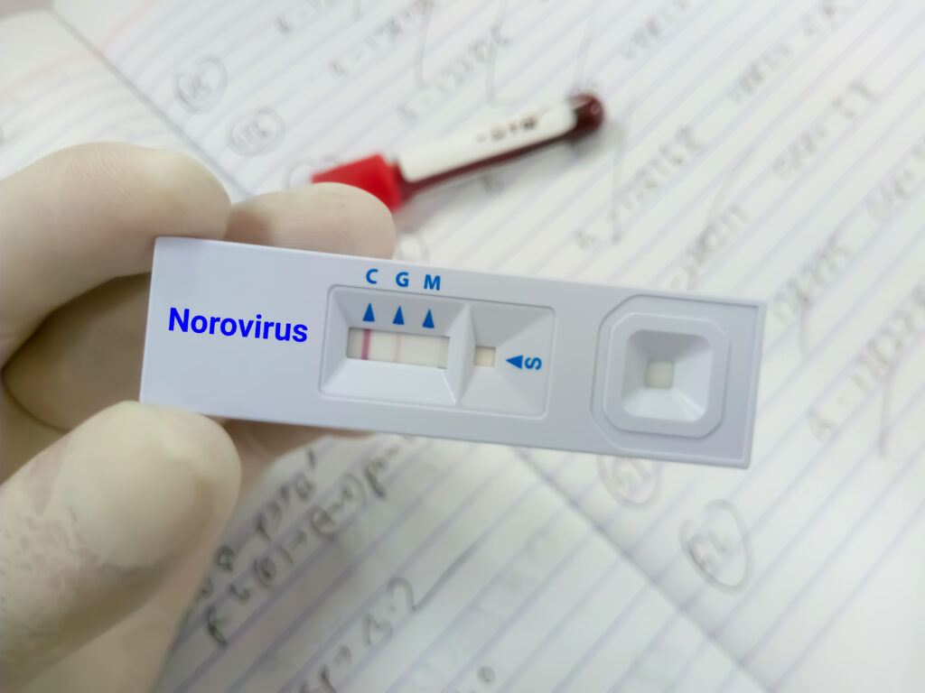 norovirus test