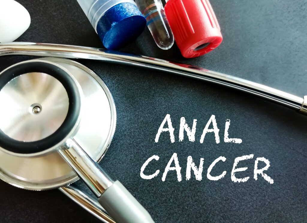 anal cancer in proctology
