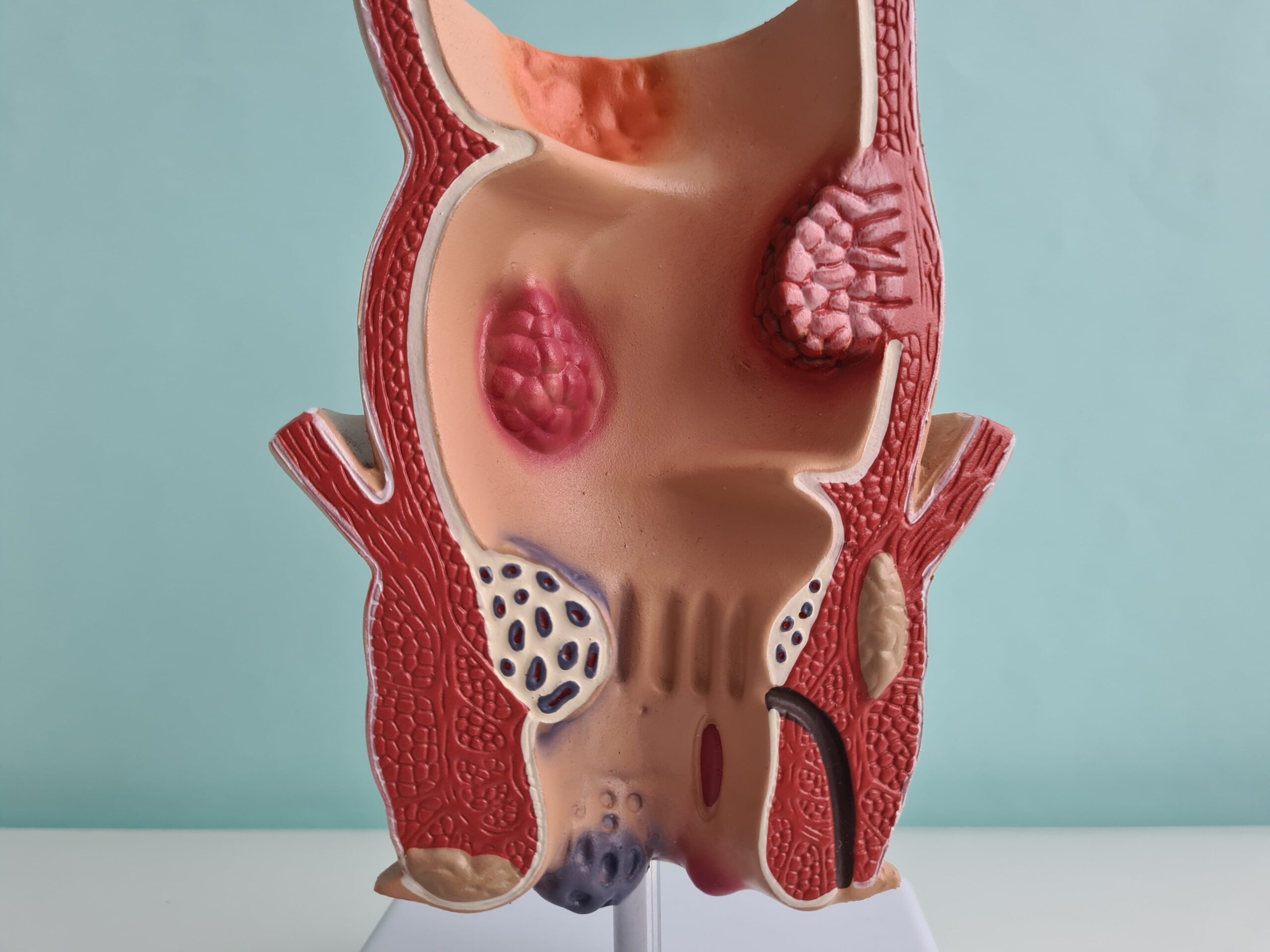 fissure anale anatomie