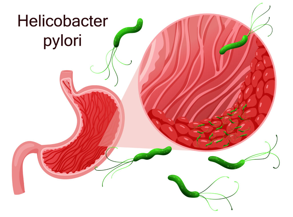 illustration helicobacter