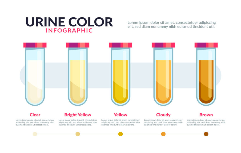 couleurs urine
